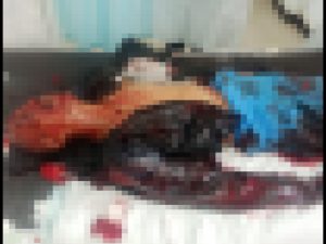 Penusukan Terhadap Tukang Ojek dan Sopir Angkot Oleh Orang Tak Dikenal