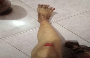 Kabur saat Kecelakaan Ringan di Km 8, Keluarga Minta Pihak Berwenang Ungkap Siapa Orangnya