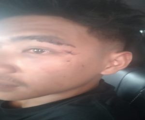 Rafli Jadi Korban Pengeroyokan di Leko Caffe, Diduga Melibatkan Oknum Loreng