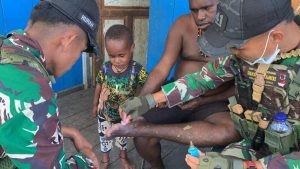 Satgas Yonif 641/Bru Gelar Pengobatan Keliling di Distrik Kobakma, Wujud Nyata Kepedulian TNI untuk Kesehatan Warga Papua